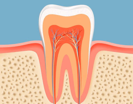 Ilustração de implante dentário